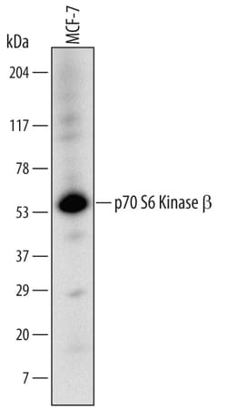 Human p70 S6 Kinase beta Antibody, R D Systems 25&mu;g; Unlabeled:Antibodies,