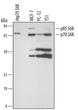 Human/Mouse/Rat p70 S6 Kinase Antibody, R D Systems 25&mu;g; Unlabeled:Antibodies,