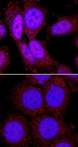Human Phospho-p70 S6 Kinase (T389) Antibody, R D Systems 100 &mu;g; Unconjugated:Antibodies,