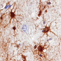 Human PADI2 Antibody, R D Systems 100&mu;g; Unlabeled:Antibodies, Polyclonal