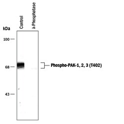 Phospho-PAK (T402) Antibody, R D Systems 100&mu;L; Unlabeled:Antibodies,