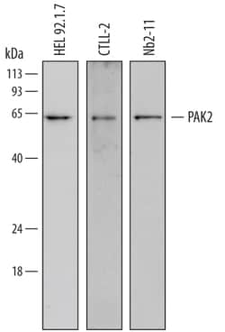 Human PAK2 Antibody, R D Systems 25&mu;g; Unlabeled:Antibodies, Monoclonal
