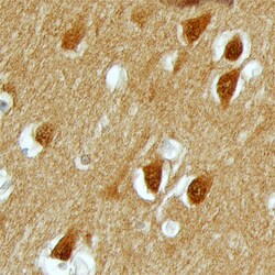 Human/Mouse PAK3 Antibody, R D Systems 100&mu;g; Unlabeled:Antibodies,