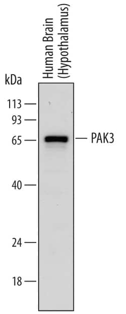 Human/Mouse PAK3 Antibody, R D Systems 100&mu;g; Unlabeled:Antibodies,