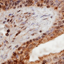 Human Palladin Antibody, R D Systems 100 &mu;g | Buy Online | R&D Systems | Fisher Scientific