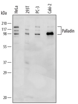 Human Palladin Antibody, R D Systems 100 &mu;g | Buy Online | R&D Systems | Fisher Scientific