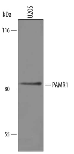Human PAMR1 Antibody, R D Systems 25&mu;g; Unlabeled:Antibodies, Polyclonal