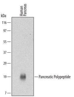 Human Pancreatic Polypeptide/PP Antibody, R D Systems 25&mu;g; Unlabeled:Antibodies,