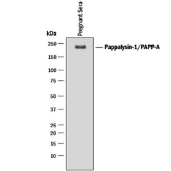 Human Pappalysin-1/PAPP-A Antibody, R D Systems 25&mu;g; Unlabeled:Antibodies,
