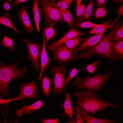 Human/Mouse Park7/DJ-1 Antibody, R D Systems 100&mu;g; Unlabeled:Antibodies,