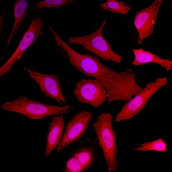 Human Park7/DJ-1 Antibody, R D Systems 25&mu;g; Unlabeled:Antibodies, Polyclonal