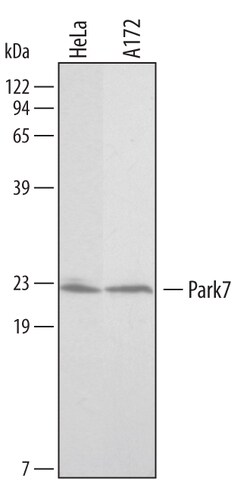 Human Park7/DJ-1 Antibody, R D Systems 25&mu;g; Unlabeled:Antibodies, Polyclonal