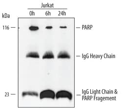 Human/Mouse PARP Antibody, R D Systems 25&mu;g; Unlabeled:Antibodies, Polyclonal