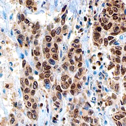 Human PARP Antibody, R D Systems 25&mu;g; Unlabeled:Antibodies, Monoclonal