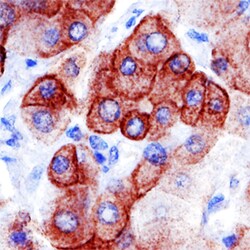 Human/Mouse Patched 1/PTCH (First Extracellular Loop) Antibody, R D Systems