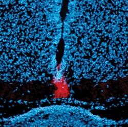 Human/Mouse Patched 1/PTCH (First Extracellular Loop) Antibody, R D Systems