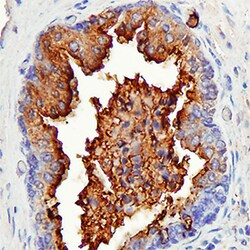 Human Patched 2/PTCH2 Antibody, R D Systems 25&mu;g; Unlabeled:Antibodies,