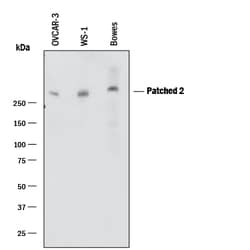Human Patched 2/PTCH2 Antibody, R D Systems 25&mu;g; Unlabeled:Antibodies,