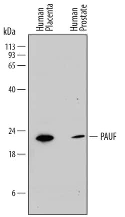 Human PAUF/ZG16B Antibody, R D Systems 25&mu;g; Unlabeled:Antibodies, Monoclonal