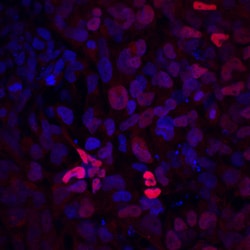 Human Pax2 Antibody, R D Systems 25&mu;g; Unlabeled:Antibodies, Polyclonal