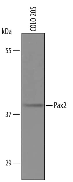 Human Pax2 Antibody, R D Systems 25&mu;g; Unlabeled:Antibodies, Polyclonal