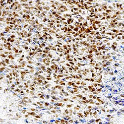 Human/Mouse Pax5/BSAP Antibody, R D Systems:Antibodies:Primary Antibodies