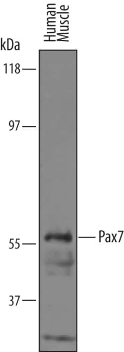 Human Pax7 Antibody, R D Systems 100&mu;g; Unlabeled:Antibodies, Polyclonal