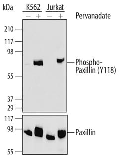 Human Phospho-Paxillin (Y118) Antibody, R D Systems 25&mu;g; Unlabeled:Antibodies,