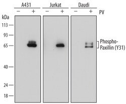 Human Phospho-Paxillin (Y31) Antibody, R D Systems 100ug; Unlabeled:Antibodies,