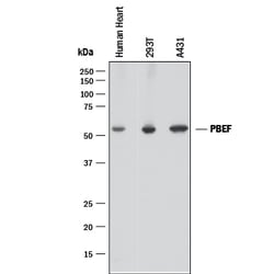 Human/Mouse/Rat PBEF/Visfatin Antibody, R D Systems 25&mu;g; Unlabeled:Antibodies,
