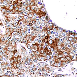 Human PDGF R alpha Antibody, R D Systems 25&mu;g; Unlabeled:Antibodies,