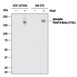 Human/Mouse Phospho-PDGF R beta (Y751) Antibody, R D Systems 25&mu;g; Unlabeled:Antibodies,
