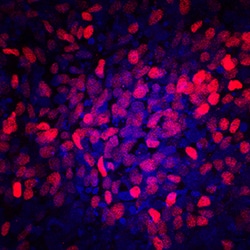 Human/Mouse PDX-1/IPF1 Antibody, R D Systems 100ug; Unlabeled:Antibodies,