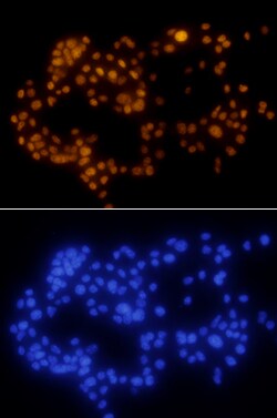 Human/Mouse PDX-1/IPF1 Antibody, R D Systems 100ug; Unlabeled:Antibodies,
