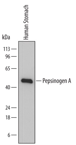 Human Pepsinogen A Antibody, R D Systems 25&mu;g; Unlabeled:Antibodies,
