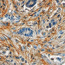 Human Periostin/OSF-2 Antibody, R D Systems 100&mu;g; Unlabeled:Antibodies,