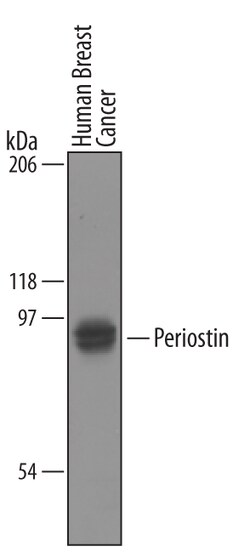 Human Periostin/OSF-2 Antibody, R D Systems 100&mu;g; Unlabeled:Antibodies,