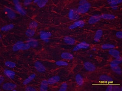 Human/Mouse Periostin/OSF-2 Antibody, R D Systems 25&mu;g; Unlabeled:Antibodies,