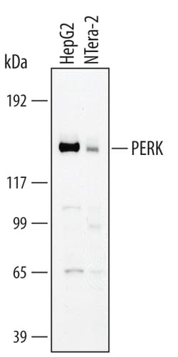 Human PERK Antibody, R D Systems 25&mu;g; Unlabeled:Antibodies, Polyclonal