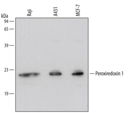 Human Peroxiredoxin 1 Antibody, R D Systems 100ug; Unlabeled:Antibodies,