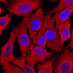 Human Peroxiredoxin 4 Antibody, R D Systems 100ug; Unlabeled:Antibodies,