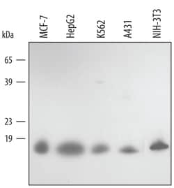 Human/Mouse Peroxiredoxin 5 Antibody, R D Systems 100&mu;g; Unlabeled:Antibodies,