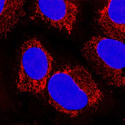 Human/Mouse/Rat Peroxiredoxin 5 Antibody, R D Systems 100&mu;g; Unlabeled:Antibodies,