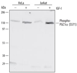 Human Phospho-PGC1 alpha (S571) Antibody, R D Systems 100&mu;g; Unlabeled:Antibodies,