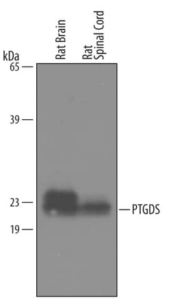 PGD2 Synthase/PTGDS Goat anti-Rat, Polyclonal, R D Systems 25&mu;g; Unlabeled,
