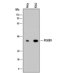 Human Phospholipid Scramblase 1/PLSCR1 Antibody, R D Systems 100ug; Unlabeled:Antibodies,
