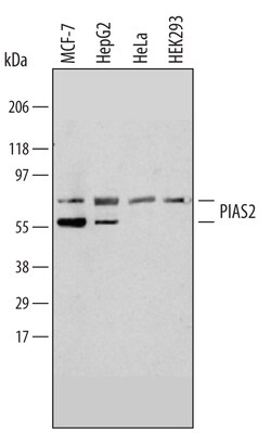 Human PIAS2 Antibody, R D Systems 100&mu;g; Unlabeled:Antibodies, Polyclonal