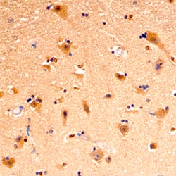 Human Piccolo Antibody, R D Systems 100&mu;g; Unlabeled:Antikroppar