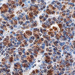 Human PITX2 Antibody, R D Systems 100&mu;g; Unlabeled:Antibodies, Polyclonal