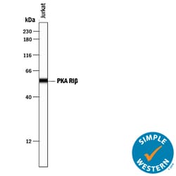 Human/Mouse/Rat PKA RI beta Antibody, R D Systems 25&mu;g; Unlabeled:Antibodies,